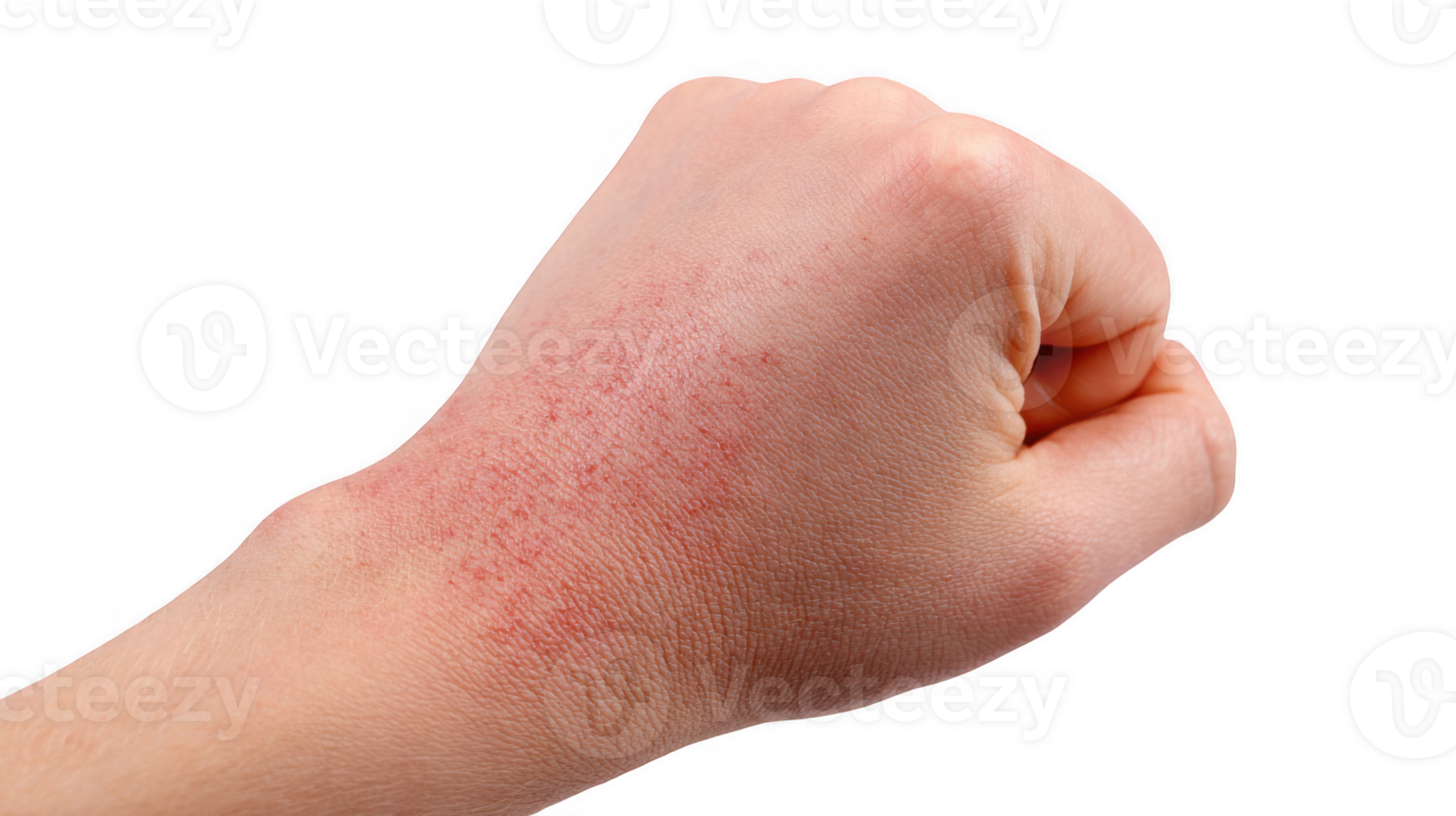 Hand showing allergy symptoms on transparent background png