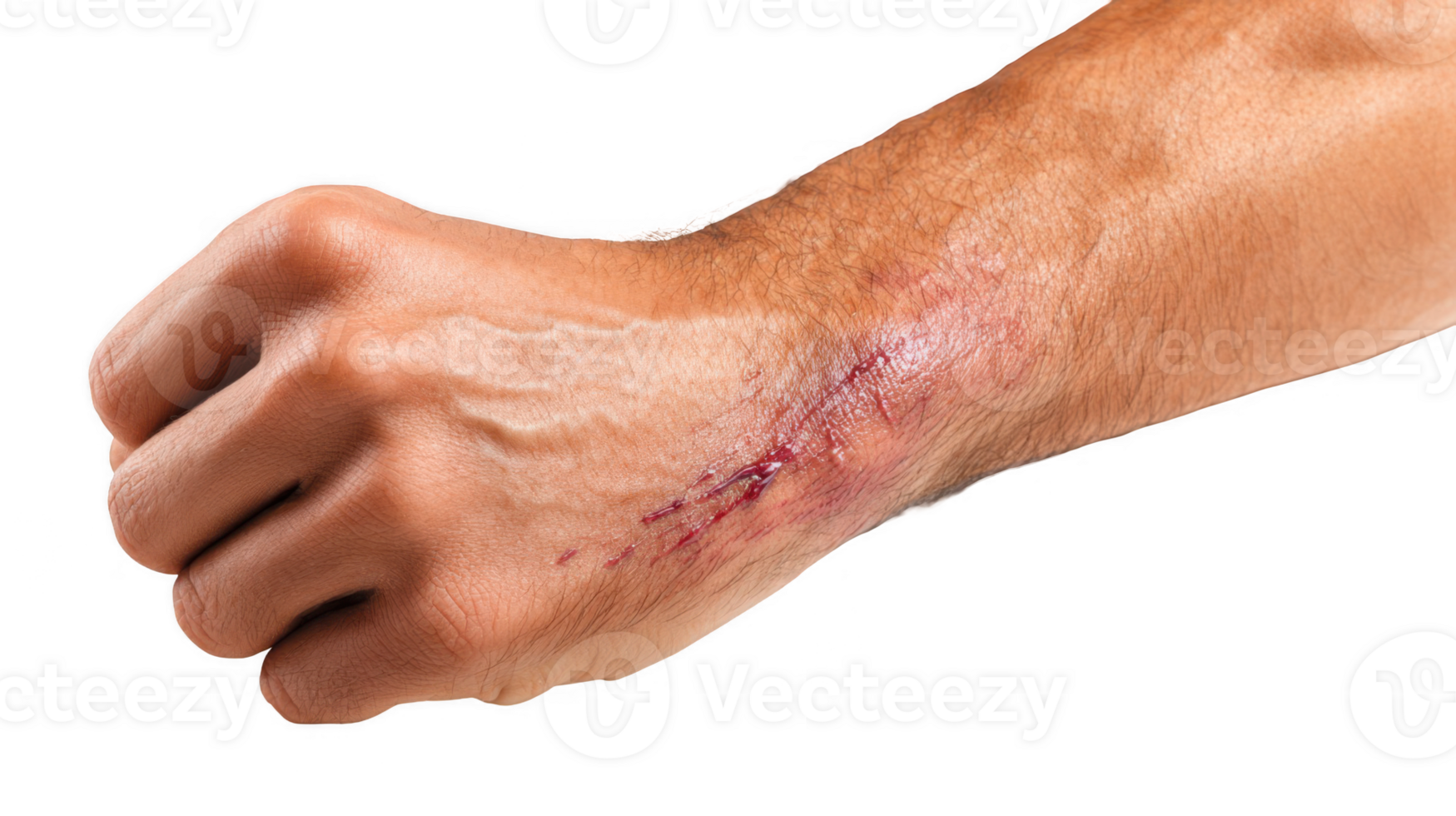 Close up of healing abrasion on man's arm with transparent background png