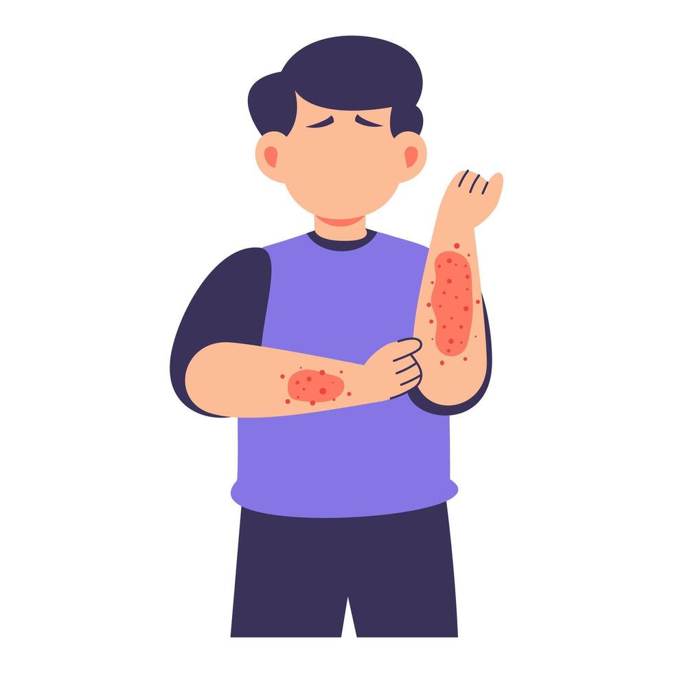 Young Boy with Rash Symptoms Showing Discomfort from Skin Allergy Reaction vector