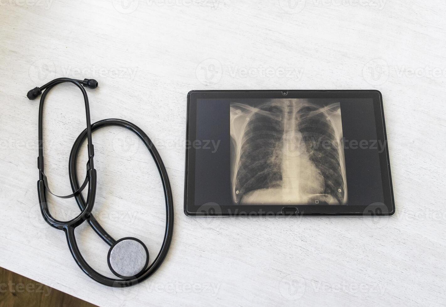Table with phonendoscope, and a X ray image of the lungs with pneumonia on the tablet. Healthcare photo