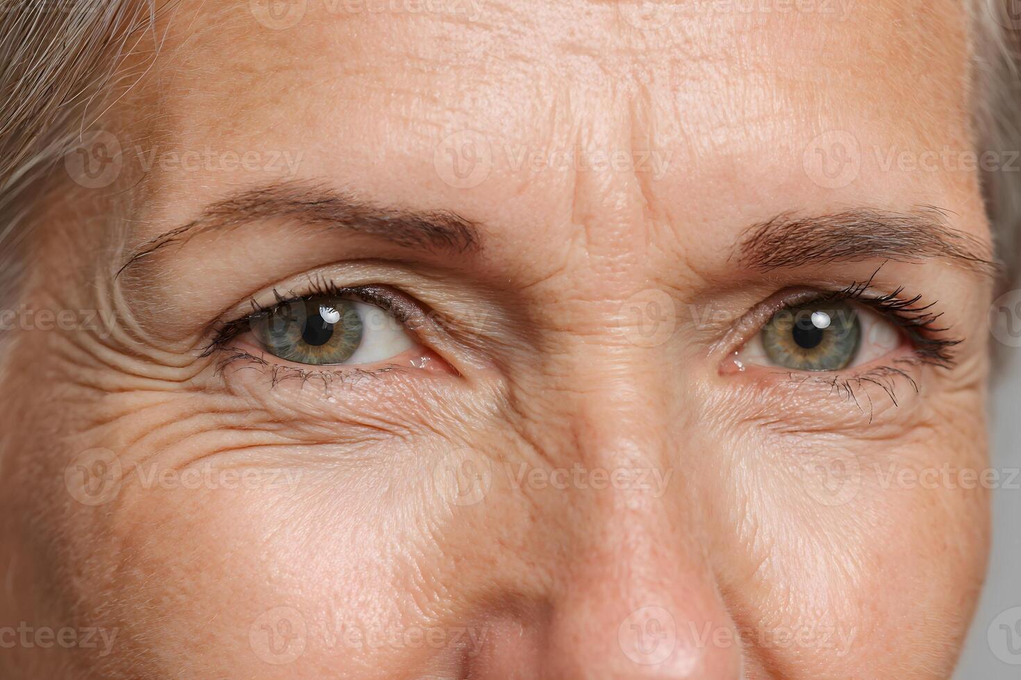 Rejuvenated look after cosmetic botox treatment photo