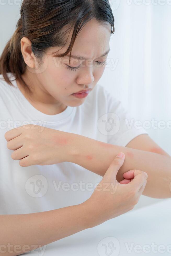 Skin problem Women have itchy skin and red rashes from cosmetic allergies, steroid allergies, sensitive skin, redness from sunlight, chemical allergies, rashes, insect bites. photo