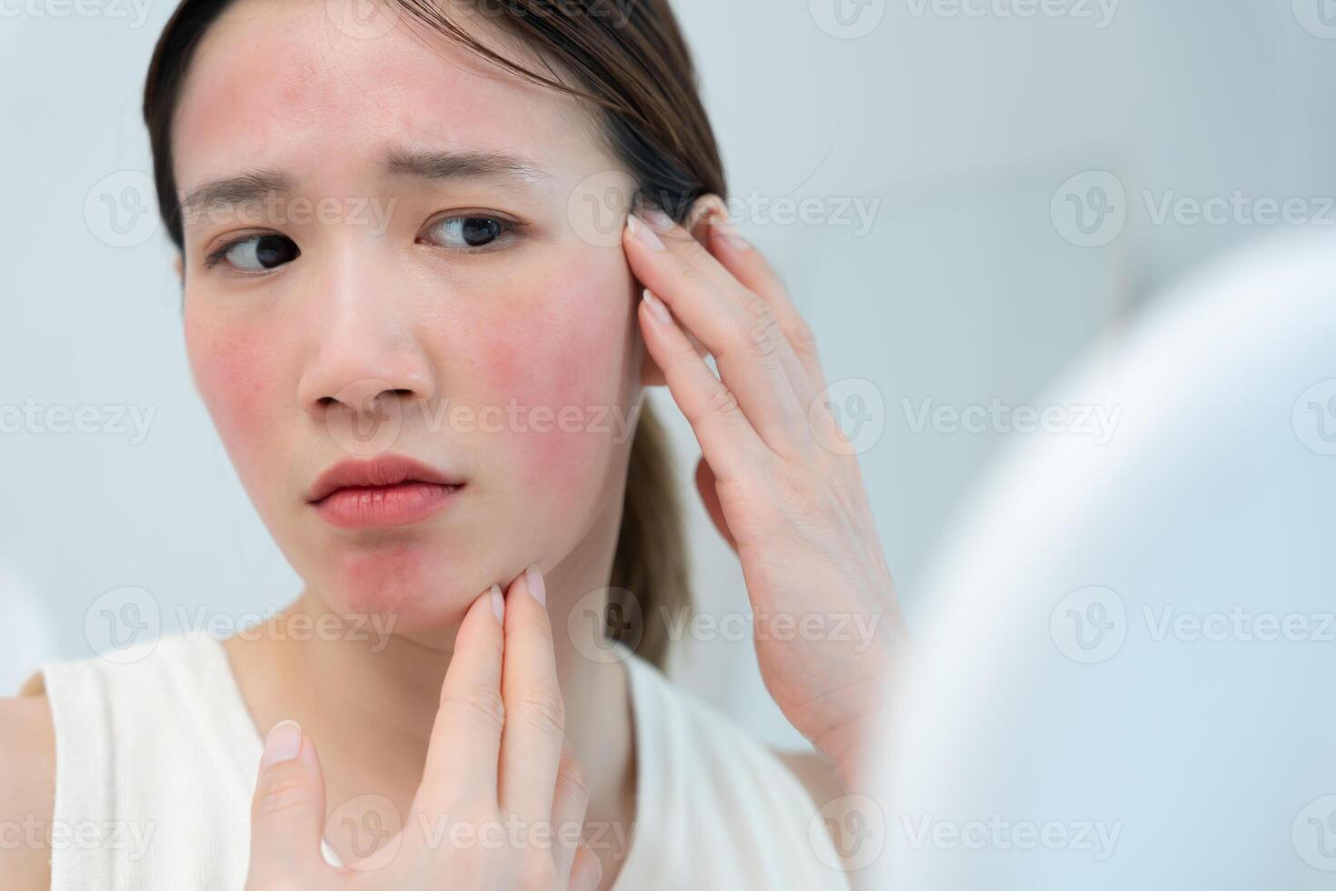 Young woman worried about faces Dermatology and allergic to steroids in cosmetics. sensitive skin, red face from sunburn, acne, allergic to chemicals, rash on face. photo