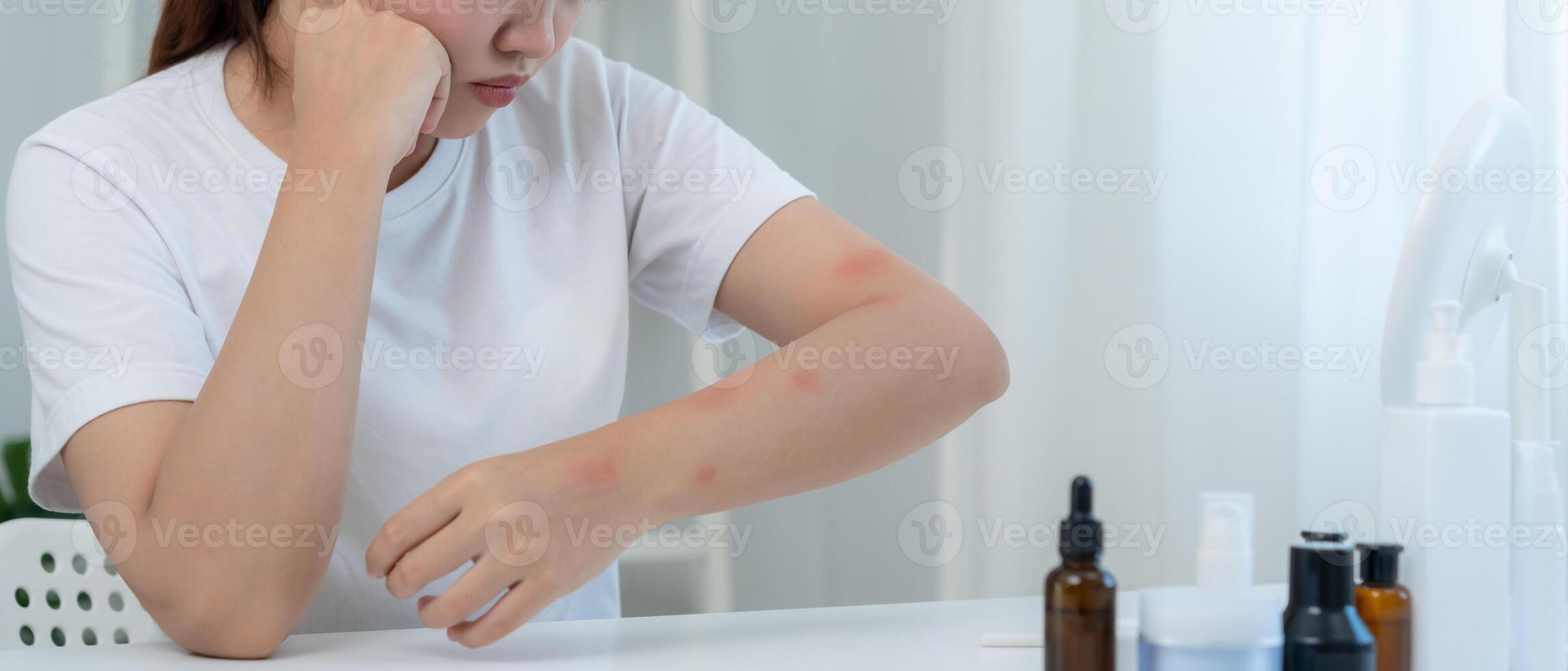 problems Women have itchy skin and red rashes from cosmetic allergies, steroid allergies, sensitive skin, redness from sunlight, chemical allergies, rashes, insect bites. photo