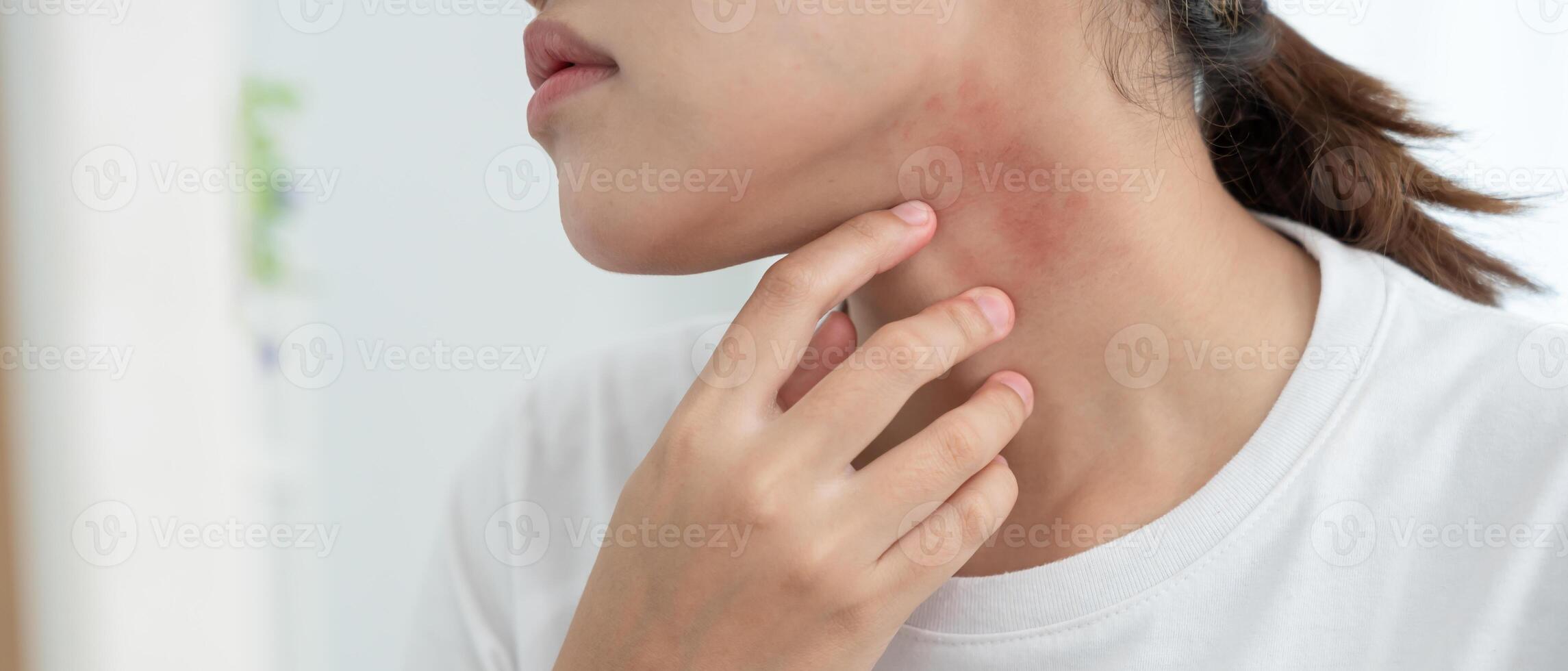 Skin and beauty problems Women have itchy skin and red rashes from cosmetic allergies, steroid allergies, sensitive skin, redness from sunlight, chemical allergies, rashes, insect bites, photo