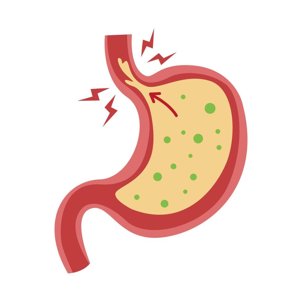 Stomach with Acid Reflux vector