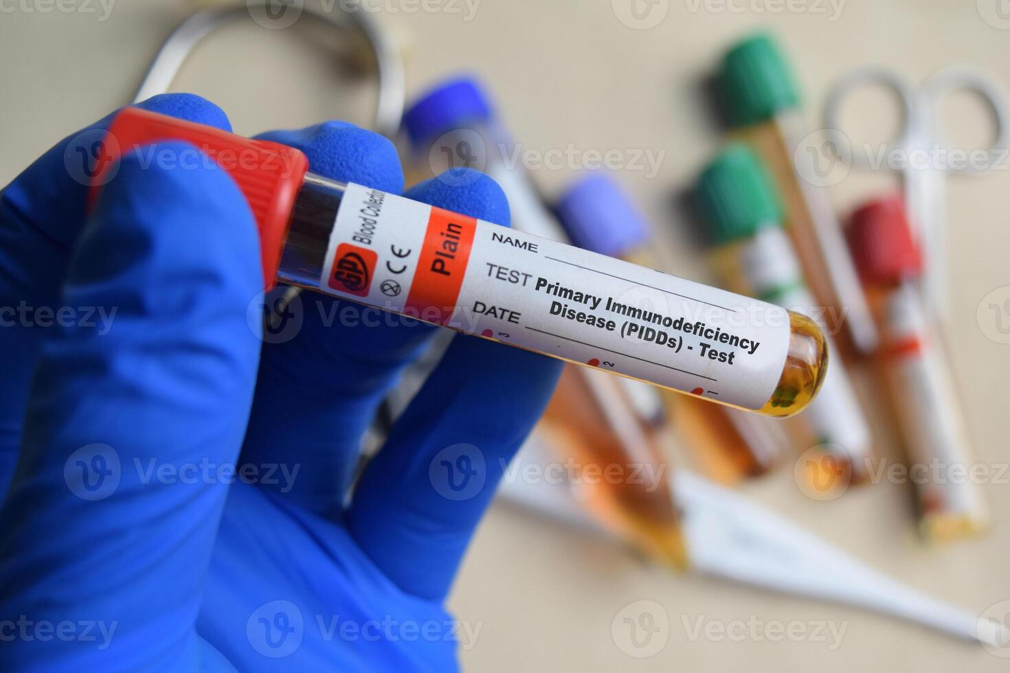 Primary Immunodeficiency Disease - PIDDs - Test with blood sample in blue gloved hands. healthcare or Medical concept photo