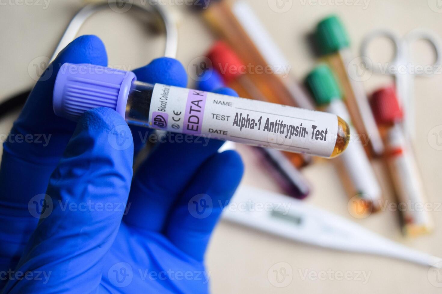 Alpha1 Antitrypsin - Test with blood sample in blue gloved hands. healthcare or Medical concept. photo
