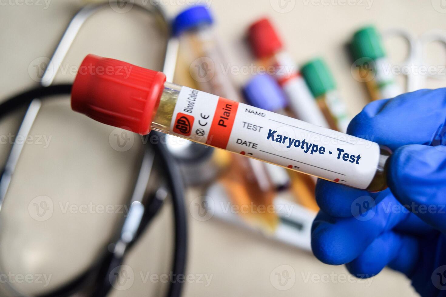 Karyotype - Test with blood sample in blue gloved hands. healthcare or Medical concept photo