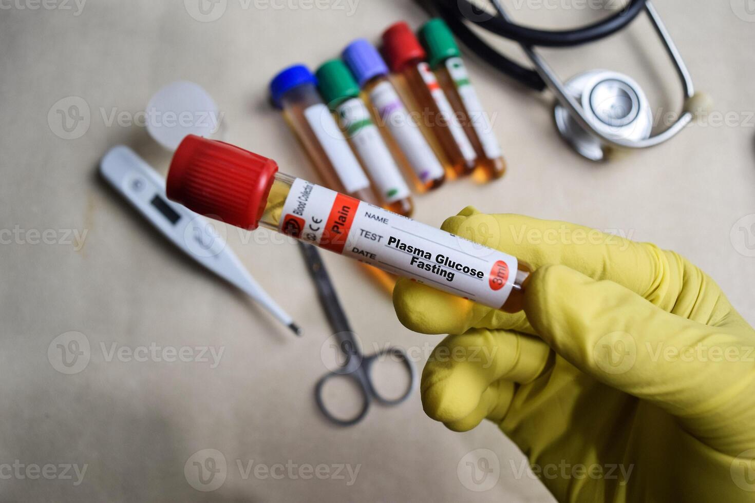 Plasma Glucose Fasting - Test with blood sample in yellow gloved hands. healthcare or Medical concept photo