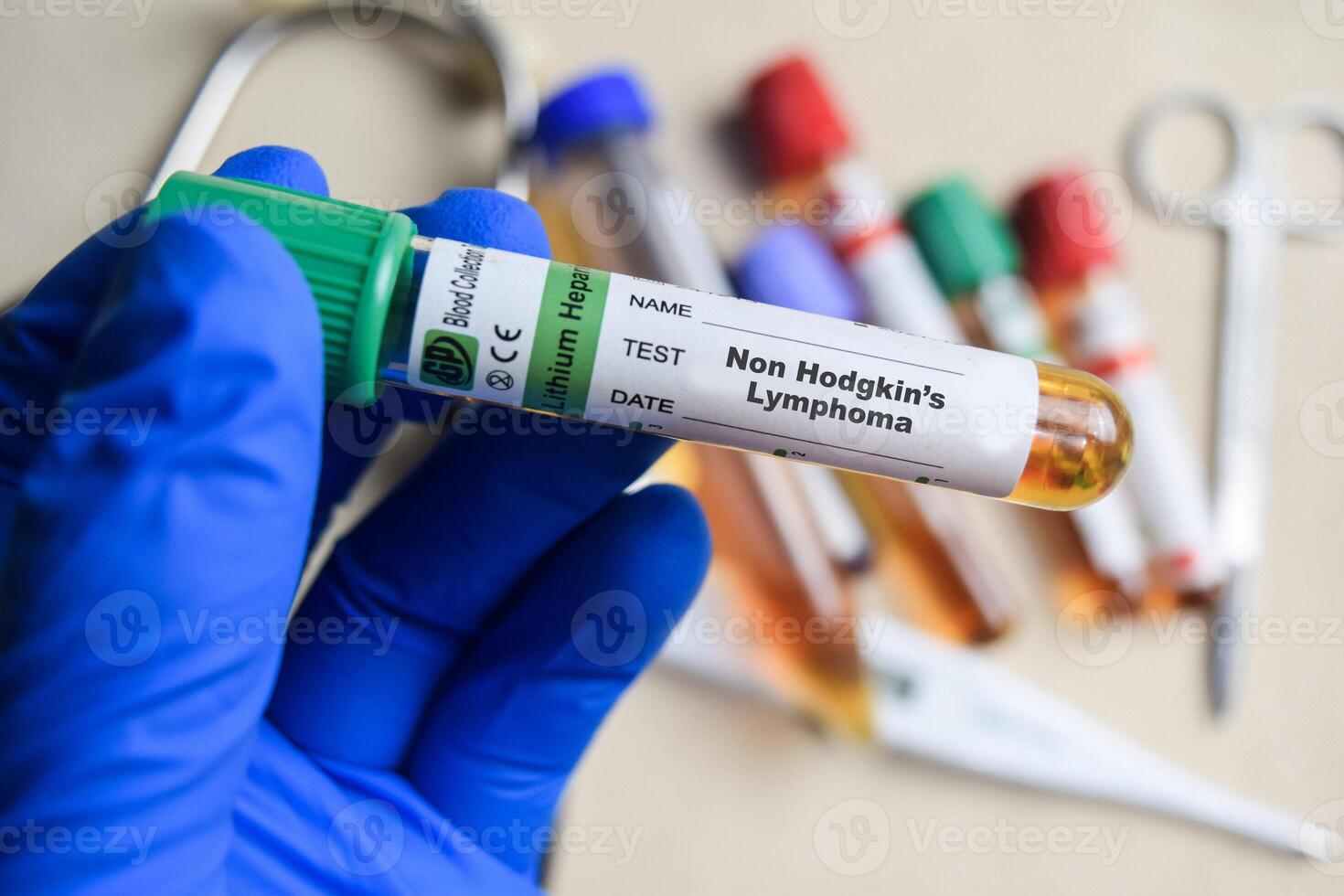 Non Hodgkins Lymphoma - Test with blood sample in blue gloved hands. healthcare or Medical concept photo