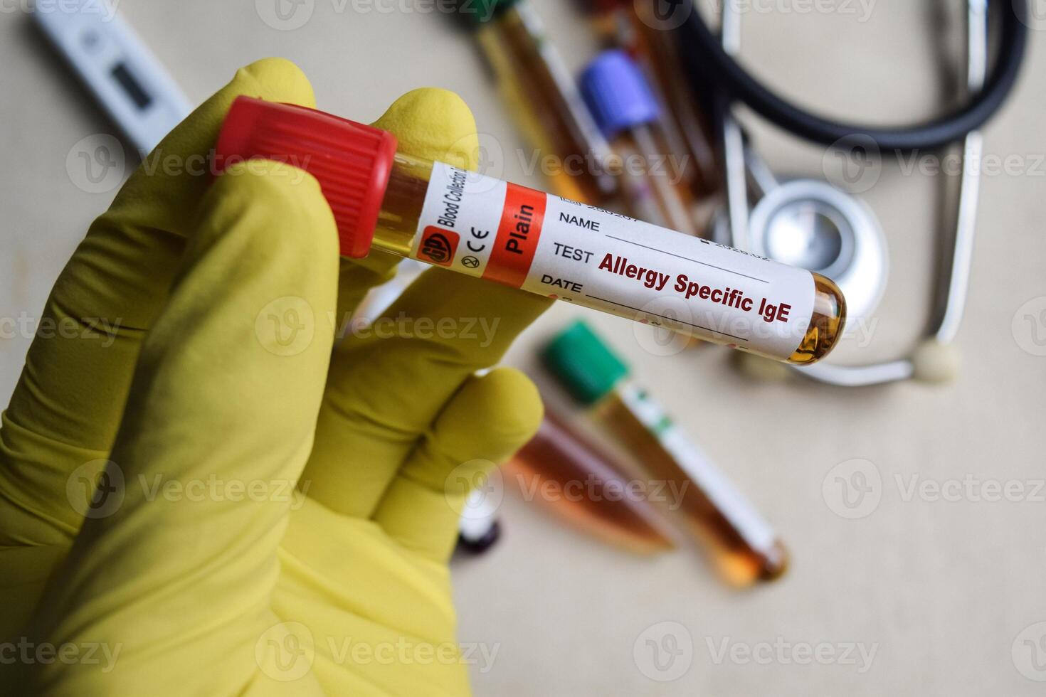 Allergy Specific lgE - Test with blood sample in yellow gloved hands. healthcare or Medical concept photo