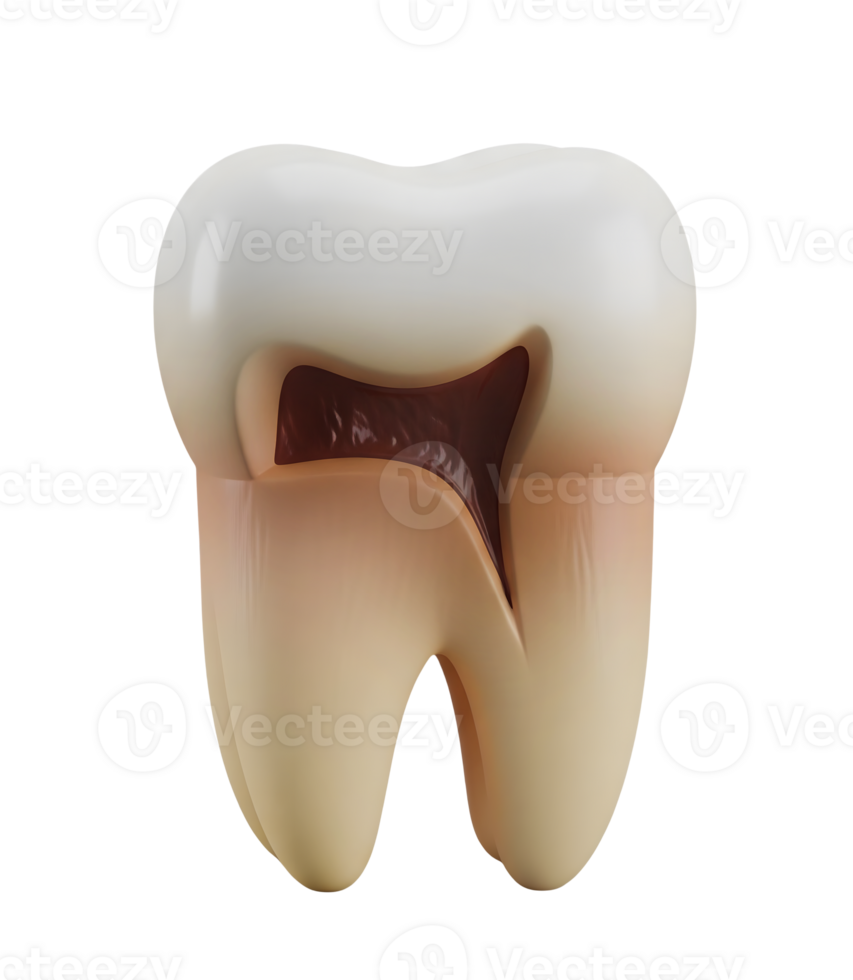 Decayed Molar with a Cavity Minimalist 3D Rendering Soft And Smooth Renderer png