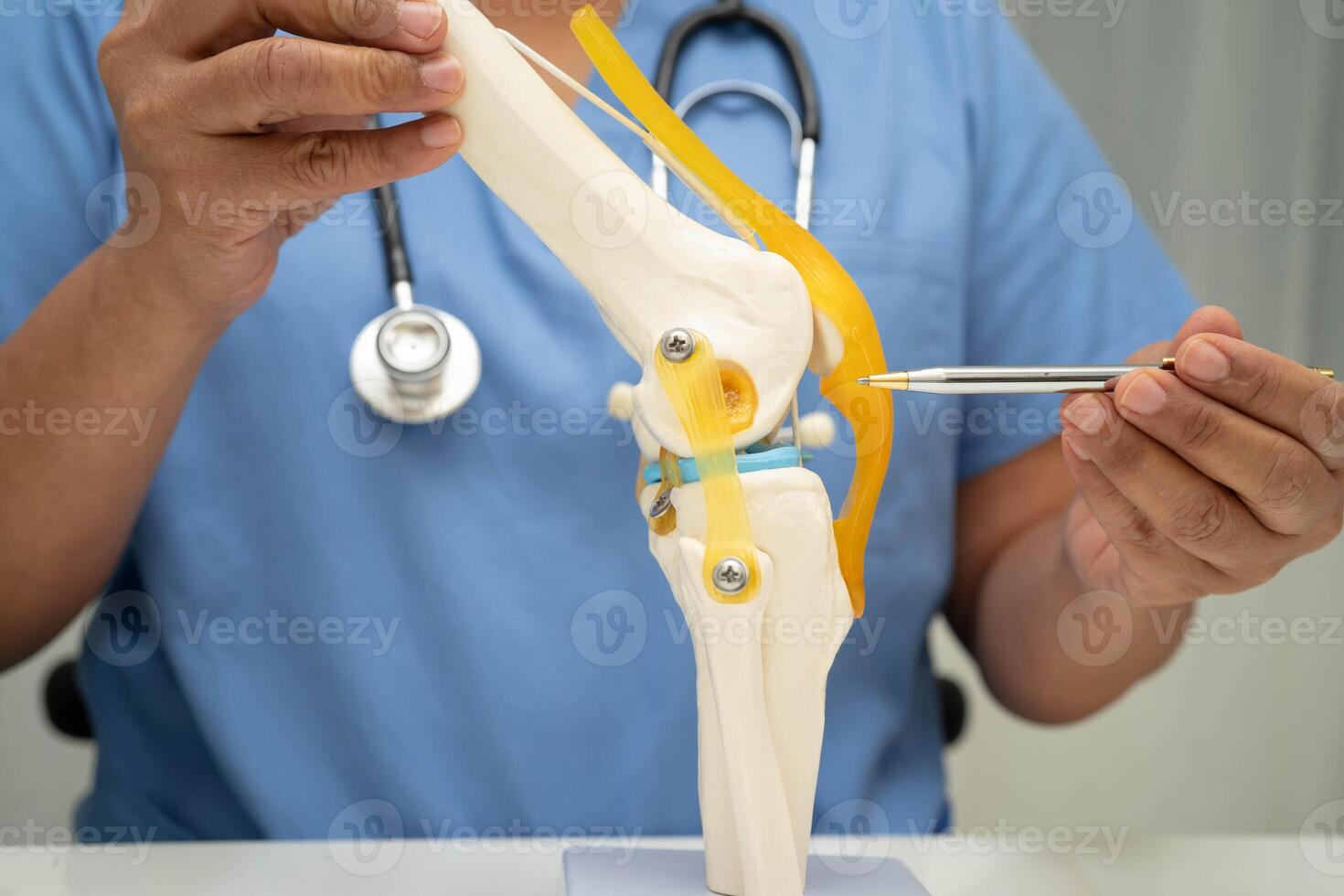 doctor holding spinal nerve and bone model, Lumbar spine displaced herniated disc fragment model photo