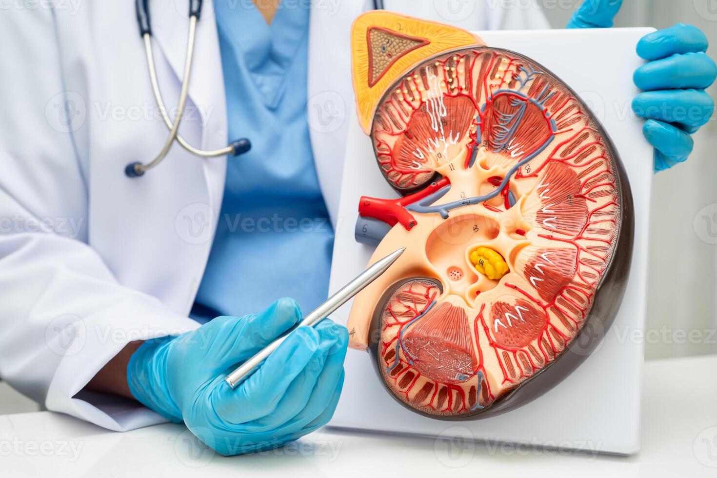 Chronic kidney disease, doctor with model for treatment urinary system rate eGFR. photo