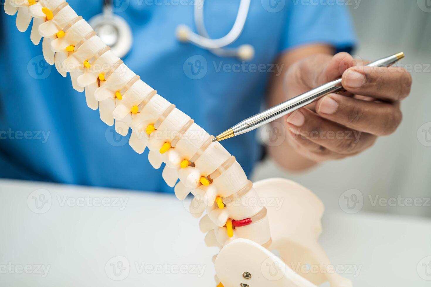doctor holding spinal nerve and bone model, Lumbar spine displaced herniated disc fragment for treatment medical orthopedic photo