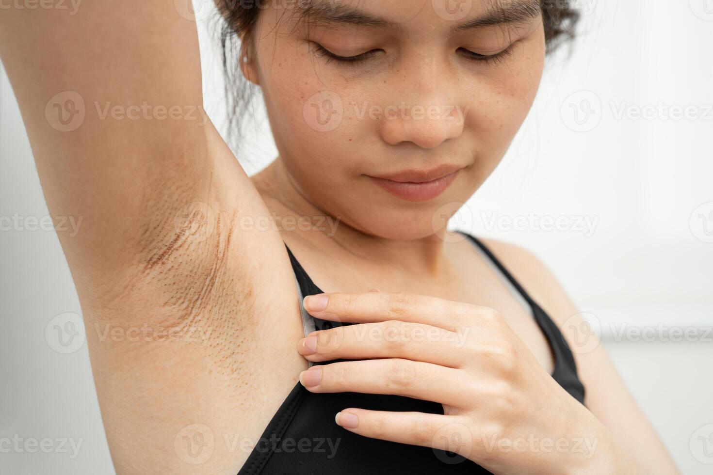 problem black armpit skin care. photo