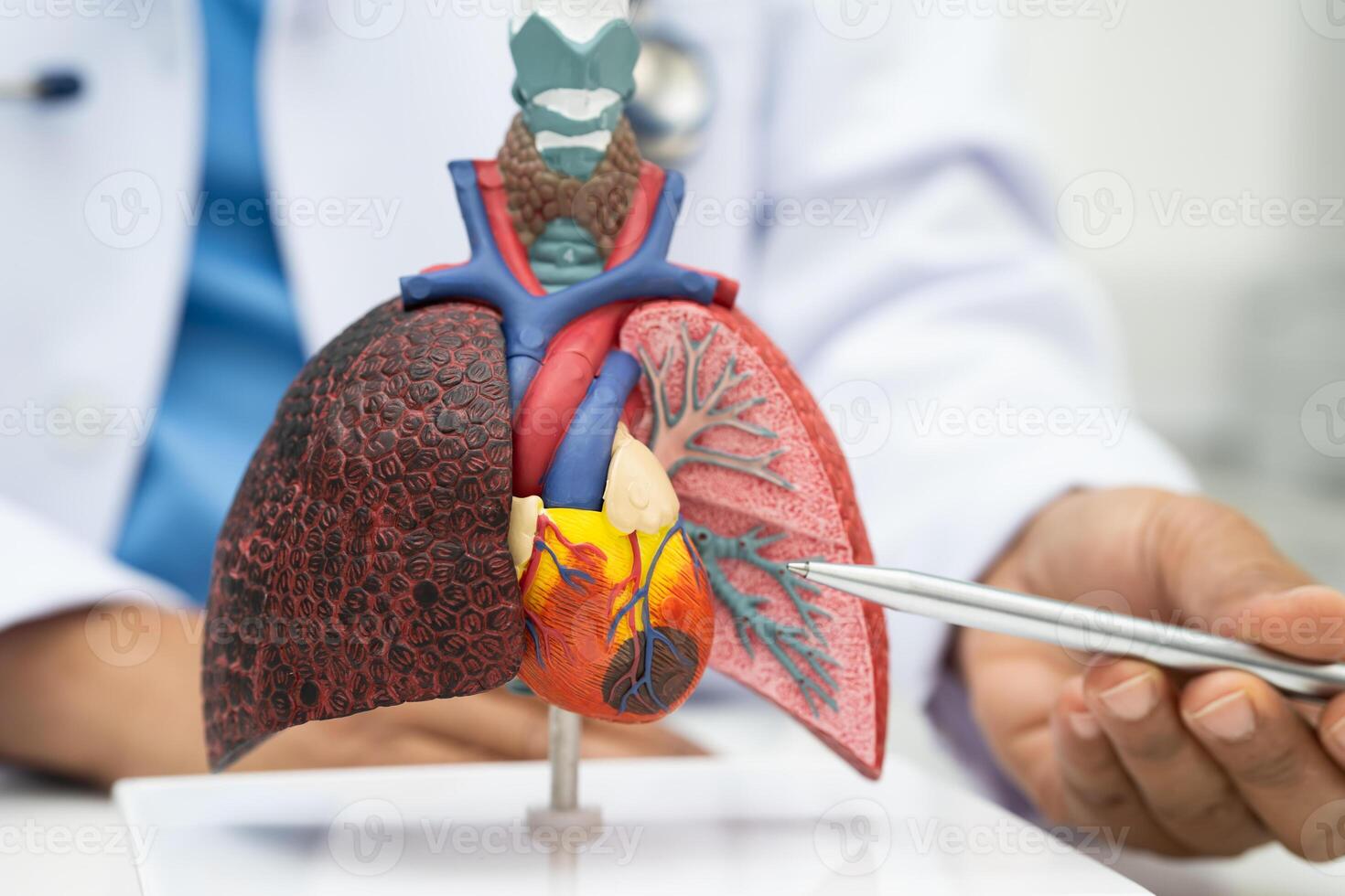Pneumonia lung cancer, Asian doctor holding human anatomy model for study diagnosis and treatment photo