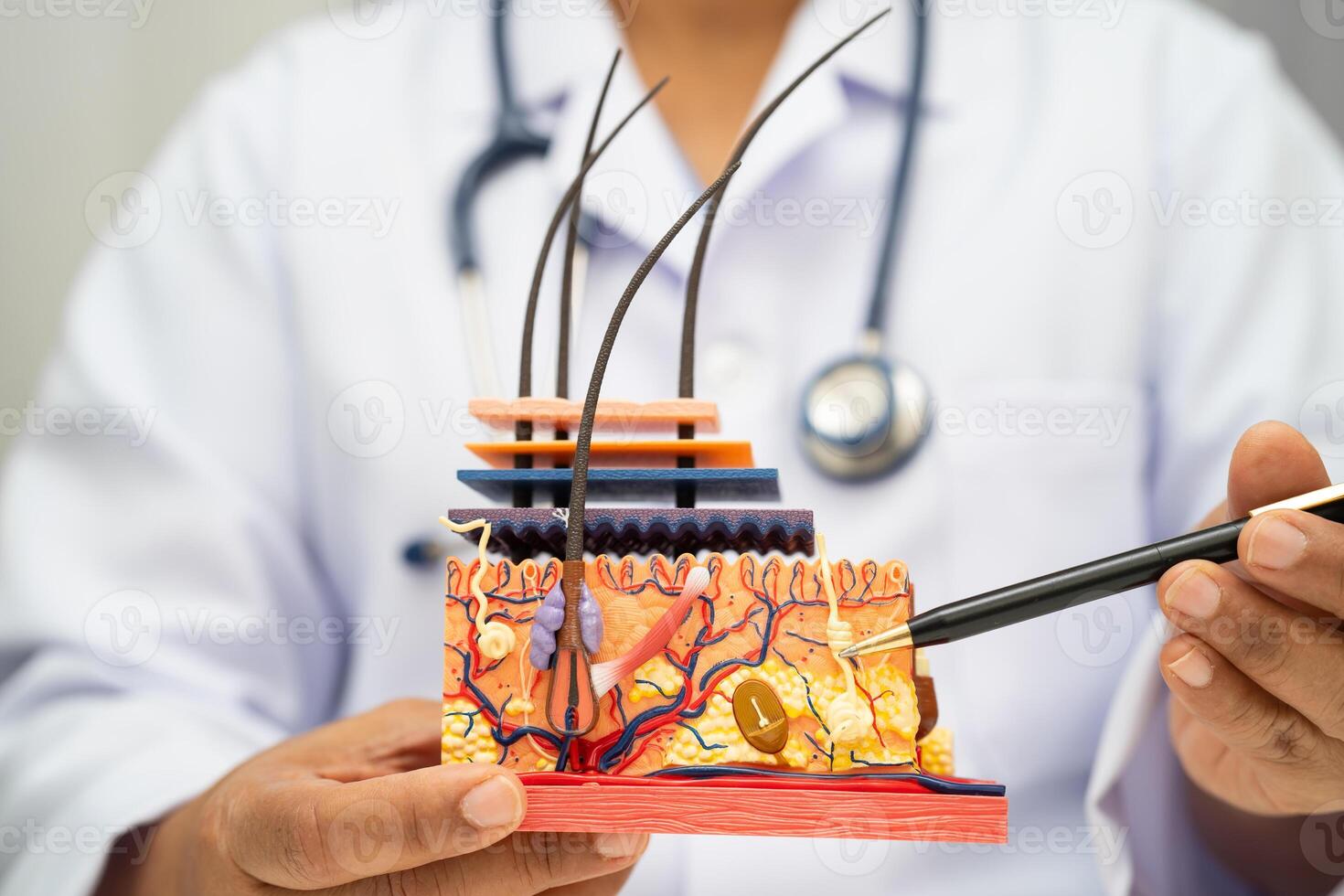 Hair transplant dermatologist doctor holding skin structure model photo