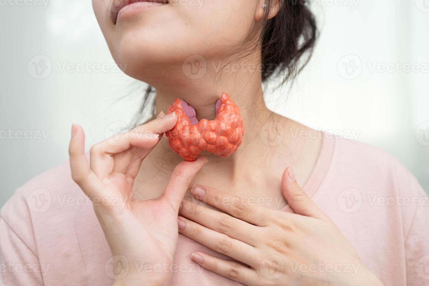 Hyperthyroidism Overactive Thyroid, Thyroid Lymphoma, Asian woman thyroid gland photo