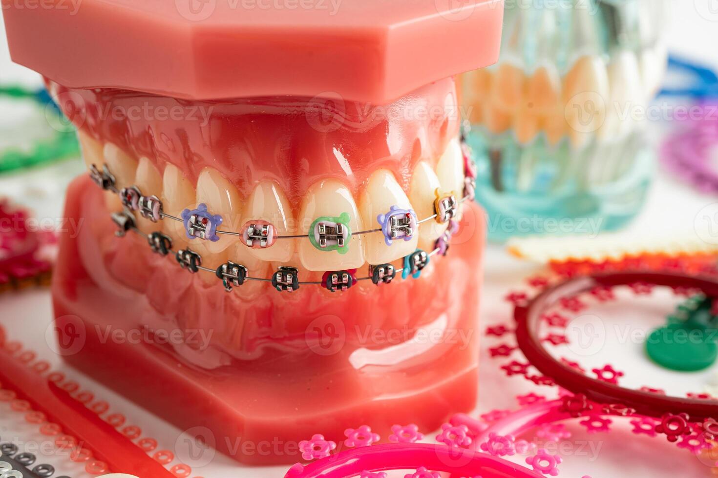Orthodontic ligatures rings and ties, elastic rubber bands on orthodontic braces model dentist photo