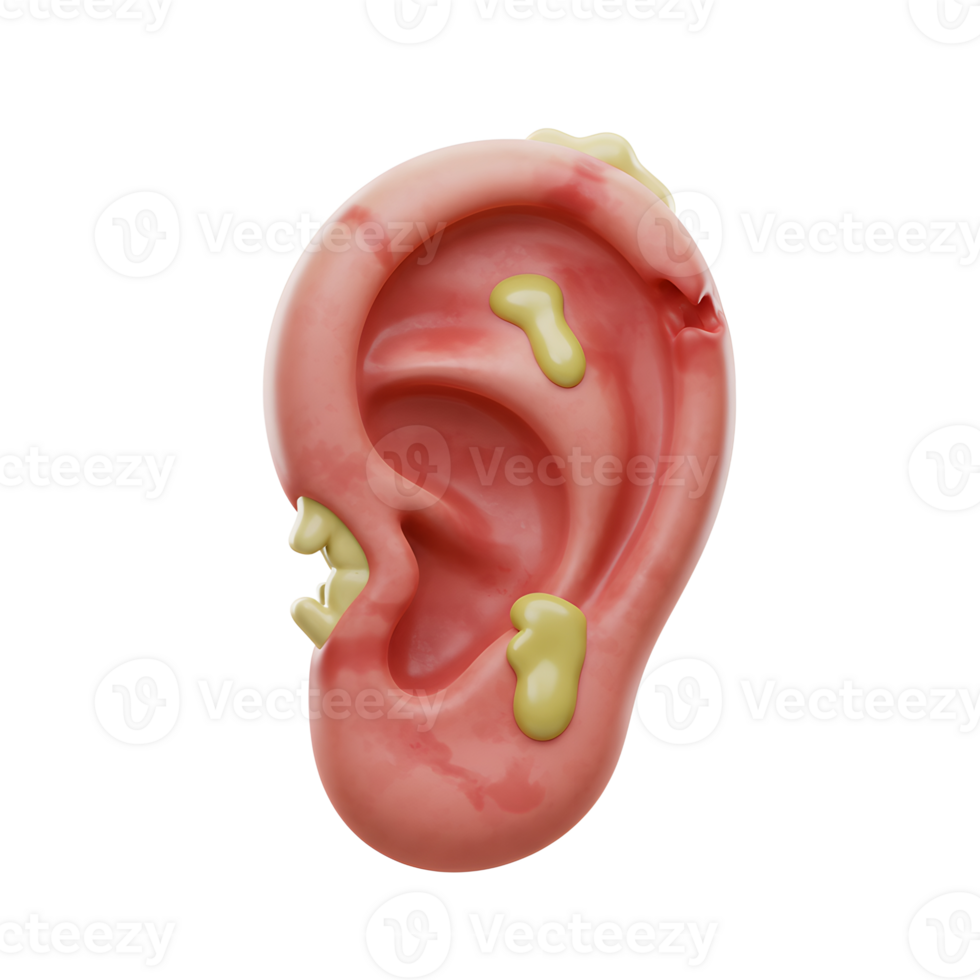 Illustration of an ear with green discharge, likely depicting an ear infection for medical visualization. png