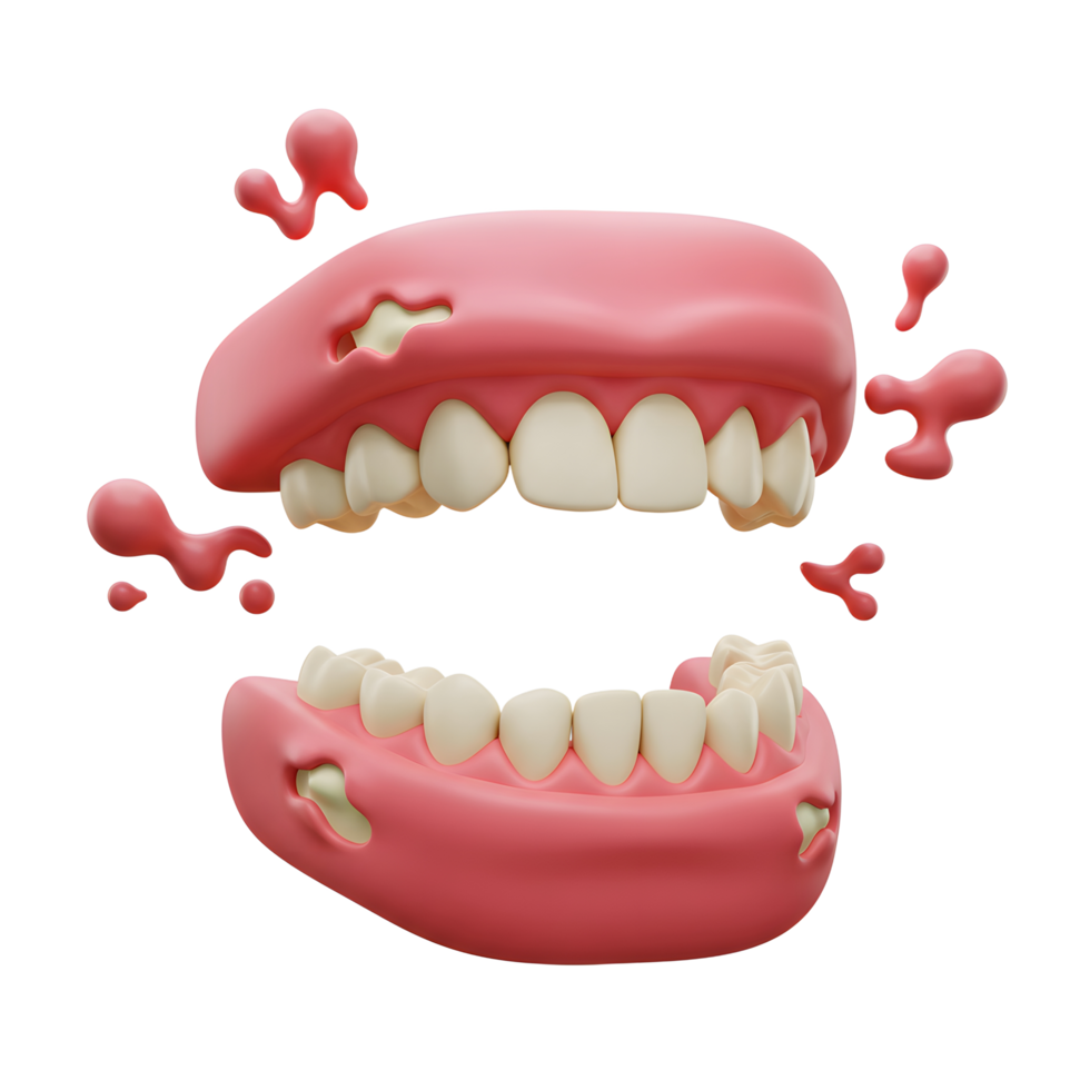 Cartoon teeth with damaged gums showing tooth decay, suitable for illustrating dental health problems. png