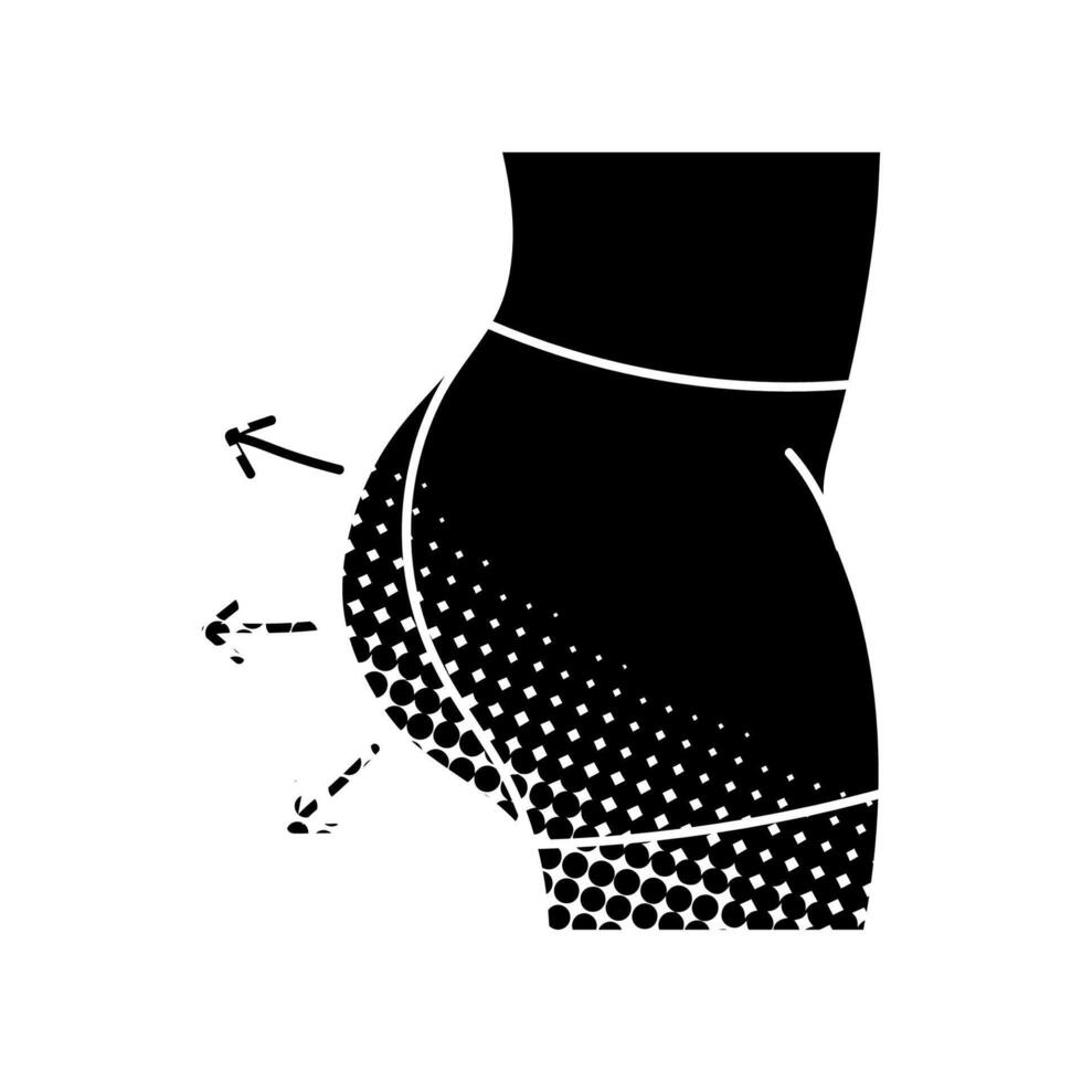 Women beauty face plastic surgery buttock augmentation body contouring black hand drawn icon in halftone texture style vector