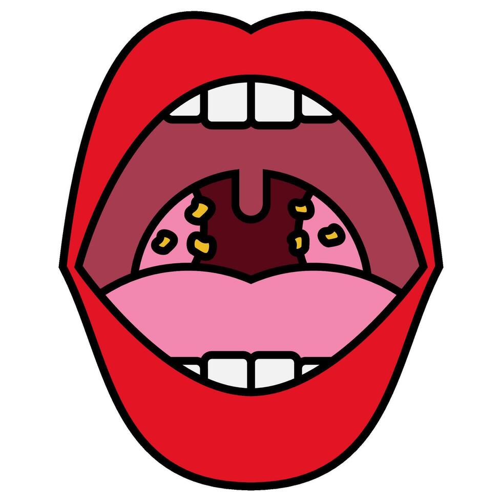 Tonsilitis filled outline icon vector