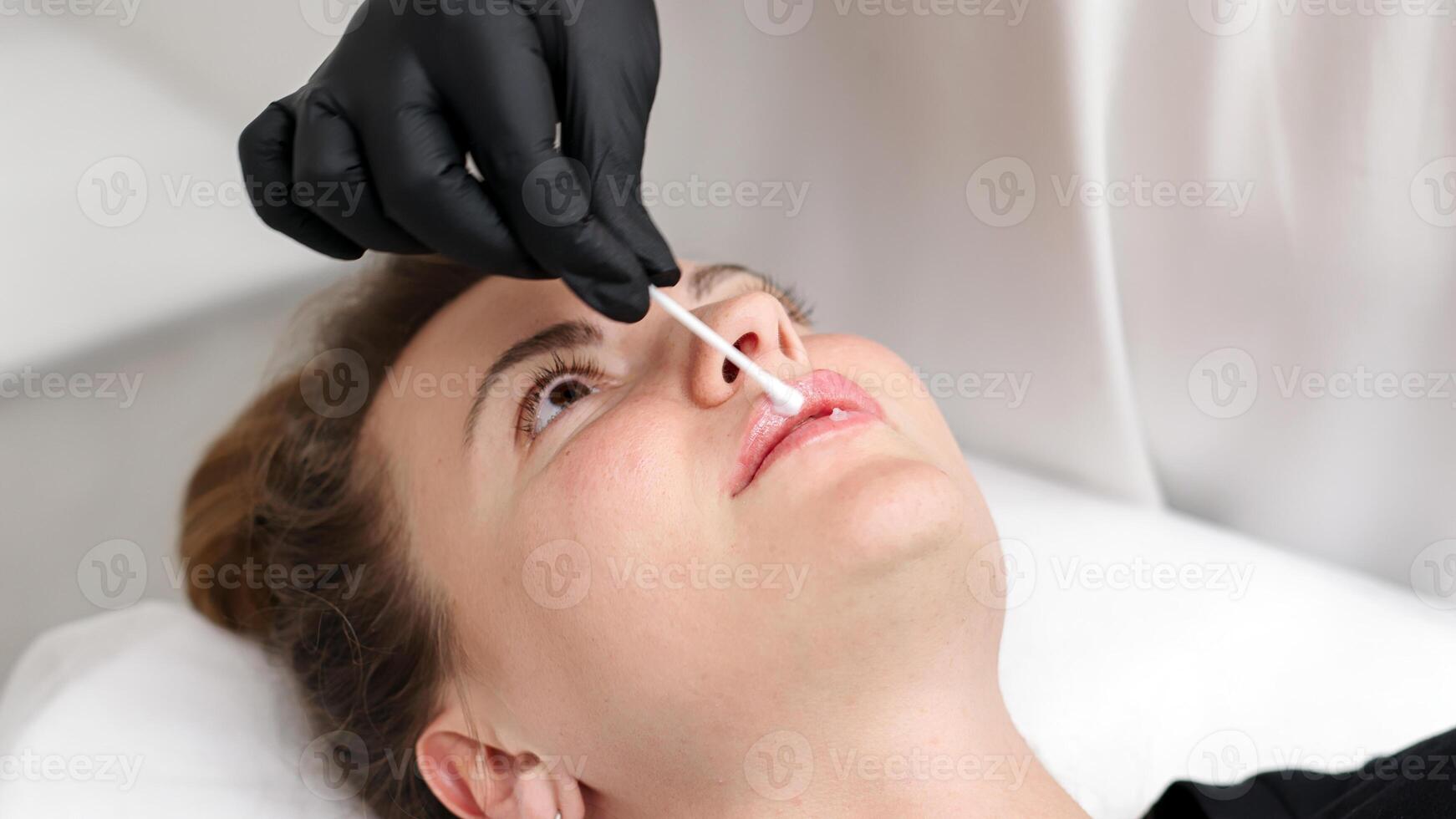 A cosmetologist's gloved hands prepare a young woman's lips before a filler injection. photo
