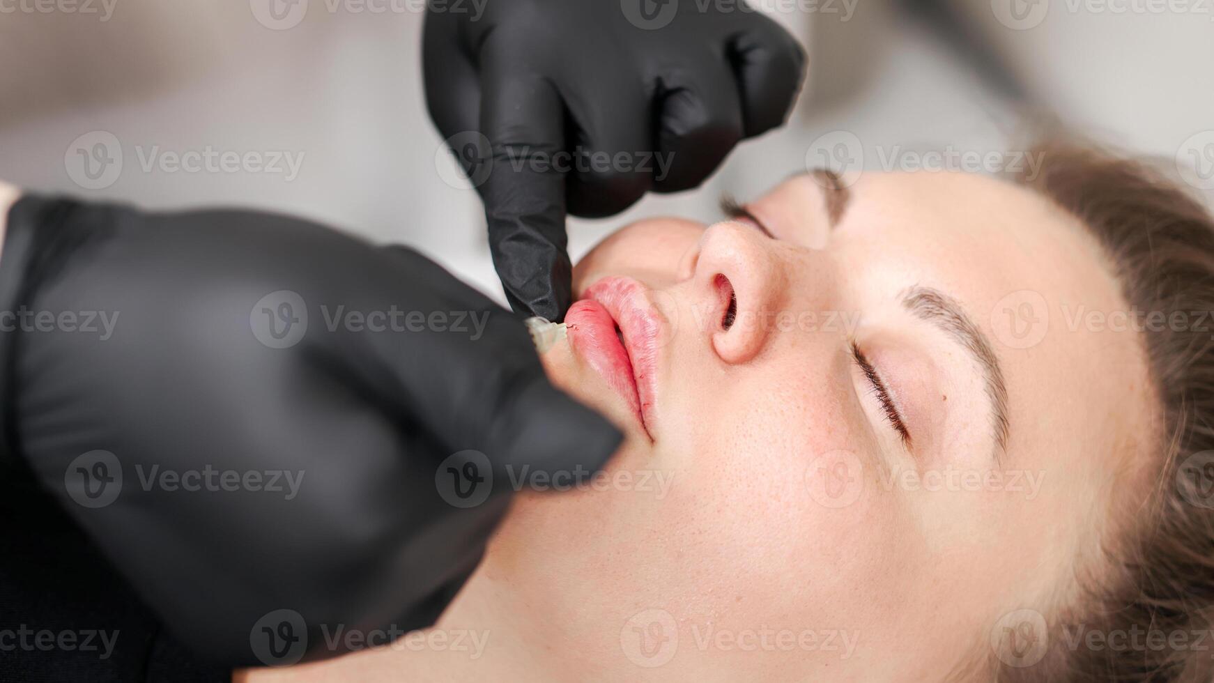 Close-up of specialist's hands giving injection to lips of young woman. Lip augmentation and correction procedure in beauty salon photo