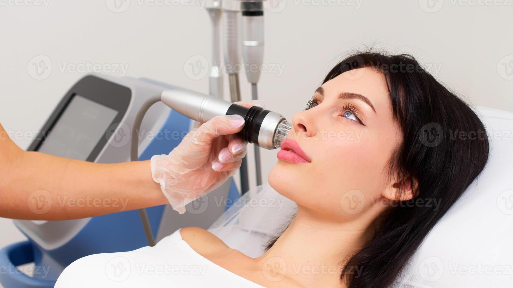 Young woman undergoing fractional radiofrequency therapy for skin rejuvenation in a medical center. Ideal for demonstrating advanced cosmetic procedures photo