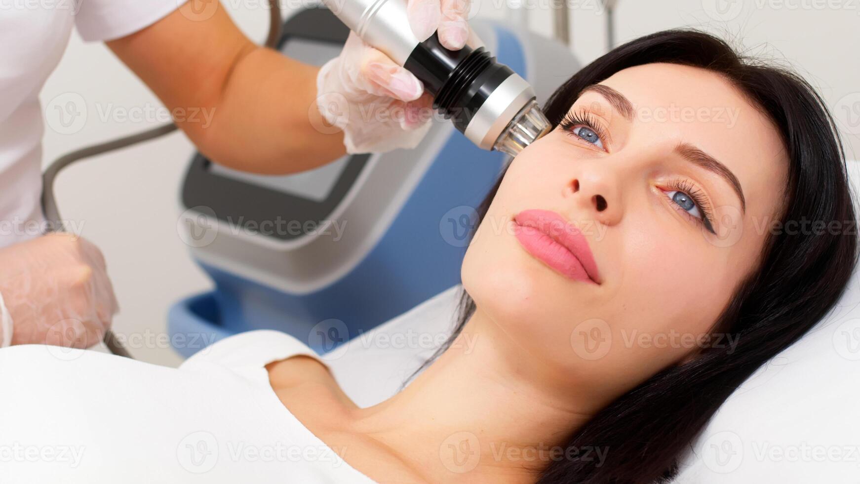 Close-up of a young woman undergoing fractionated radiofrequency treatment for skin rejuvenation at a medical center. Ideal for demonstrating advanced cosmetic procedures. photo