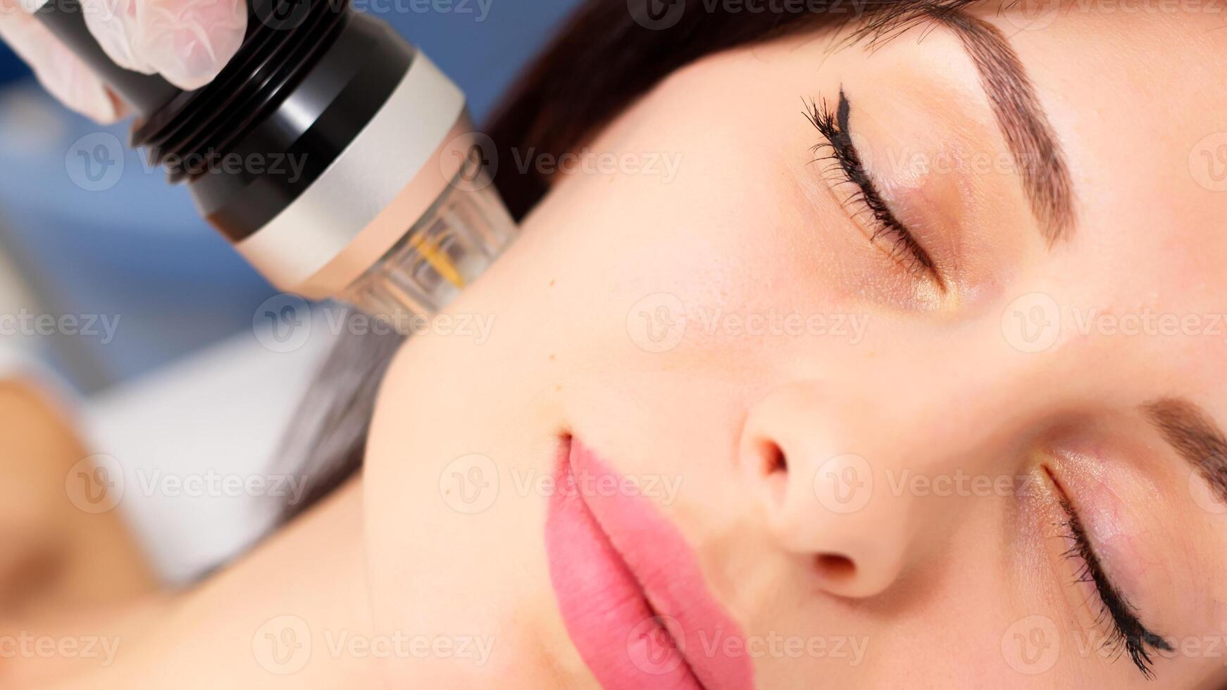 Close-up of a young girl undergoing fractional radiofrequency facelift at a medical center, skin rejuvenation concept. Cosmetic procedures advertising concept. photo
