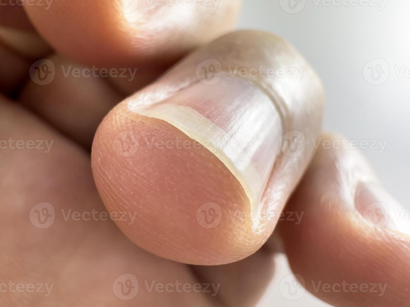 Male feet close up, macro picture, white clean nails, fingerprint photo