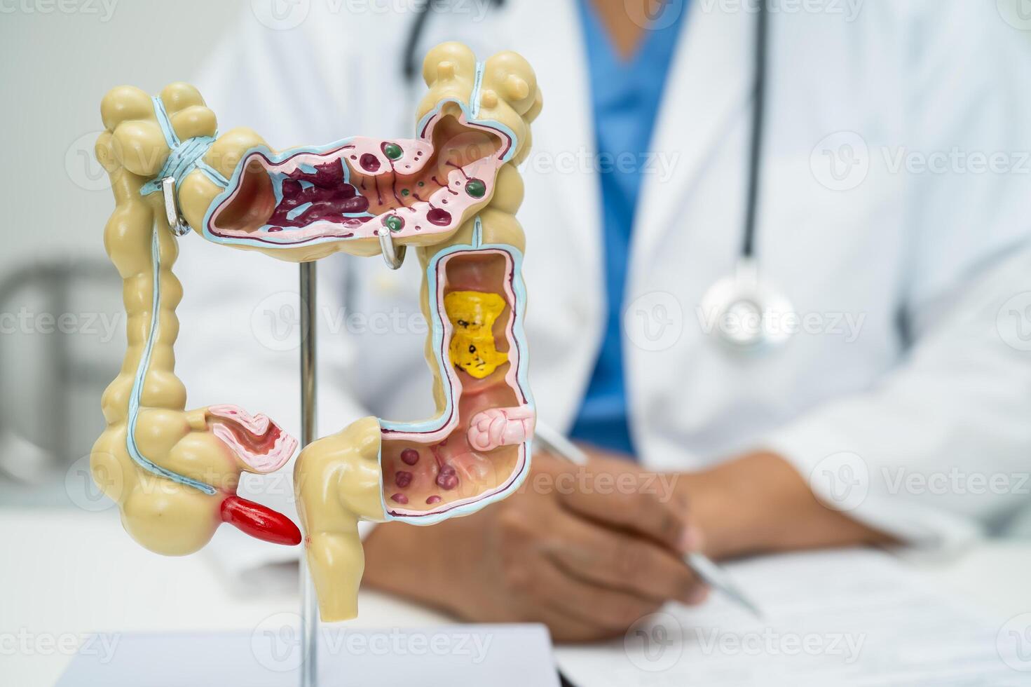 Intestine appendix digestive system, doctor holding anatomy model for study diagnosis and treatment in hospital. photo