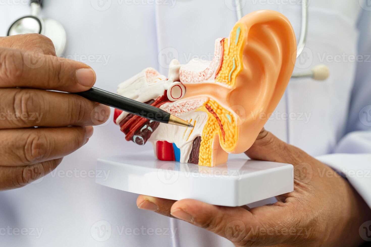 human ear model to learn and treat hearing loss in patient. photo
