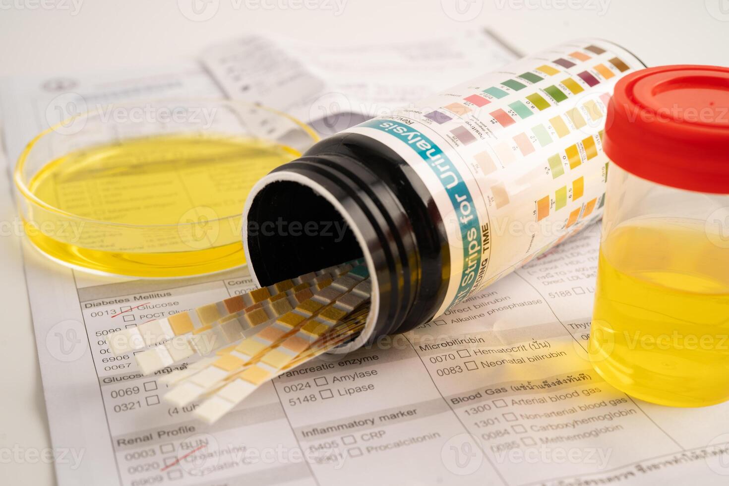 Urinalysis, urine cup reagent strip pH paper test and comparison chart in laboratory. photo