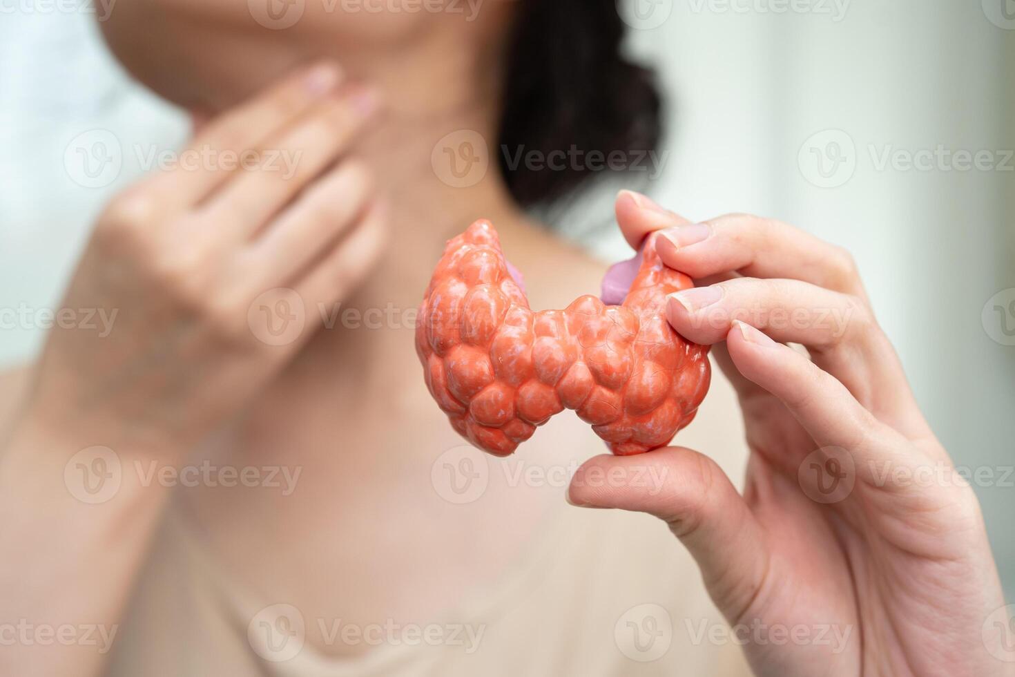 Hyperthyroidism, Overactive Thyroid, Thyroid Lymphoma, Asian woman with thyroid gland human photo