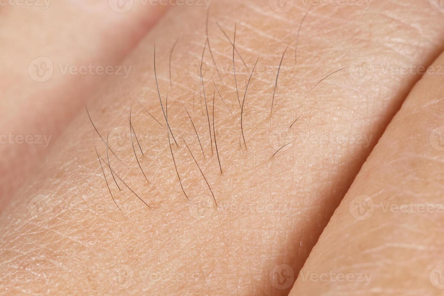 Hair on skin texture for pattern photo