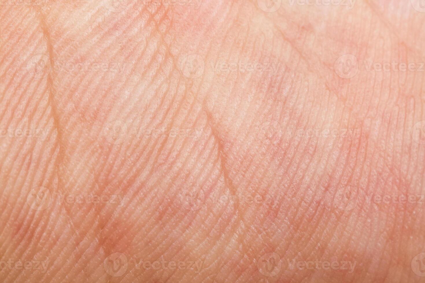 tracery hand skin texture for pattern photo