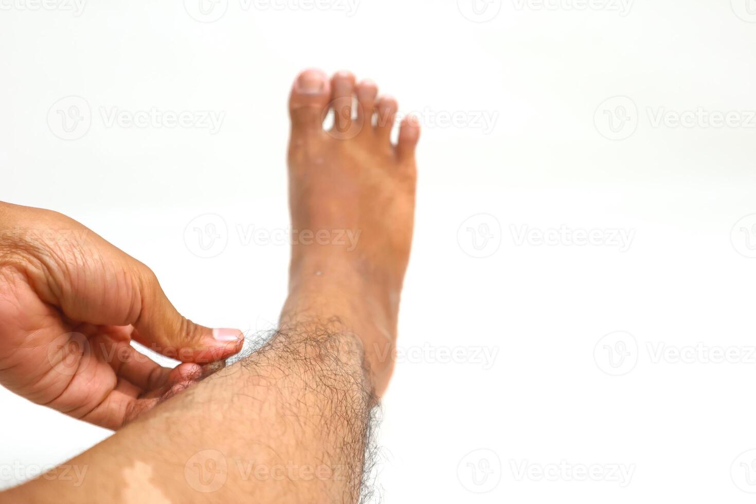 Close-up of a person's leg and foot against a white background showing skin and hair photo