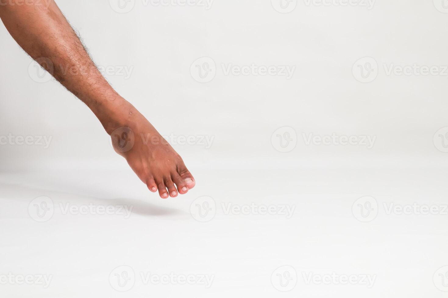 Close-up of the Foot and Leg of a Man Against a Clean White Background for Medical Reference and Podiatry photo