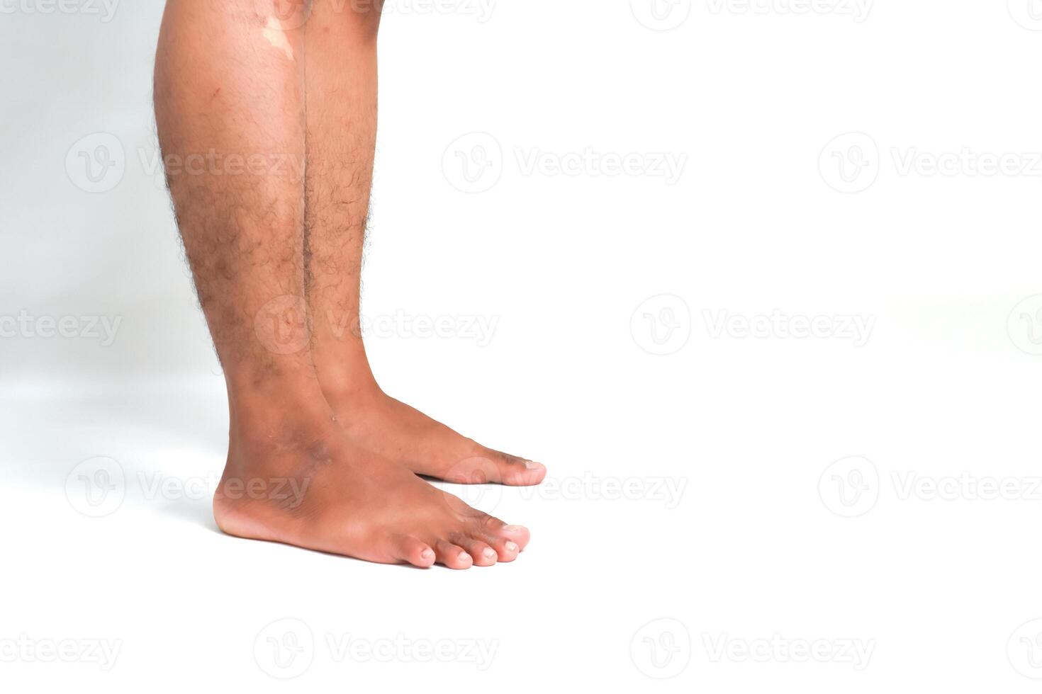 Close-up studio shot of a man's legs and feet against a plain white background, showcasing skin detail photo