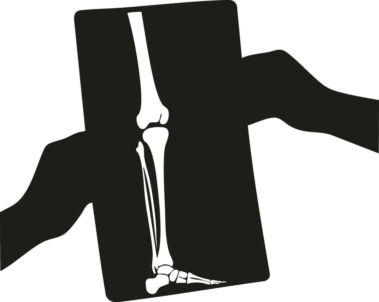 Human leg x-ray medical diagnostic illustration showing bones and joints in black and white style vector
