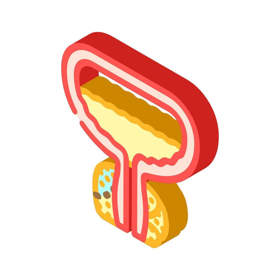 prostatectomy urology isometric icon illustration vector
