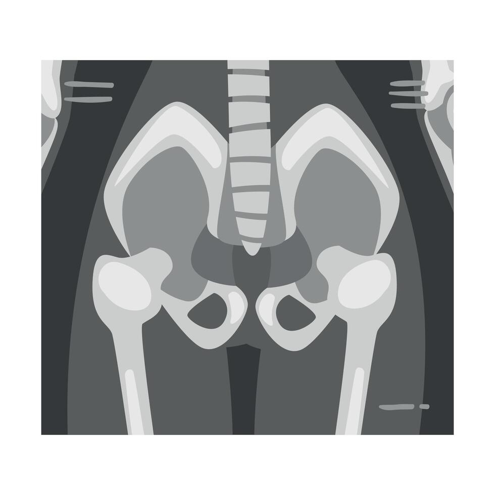 X-ray Film of Coxofemoral Joint Front View Illustrated Image for Educational Purpose vector