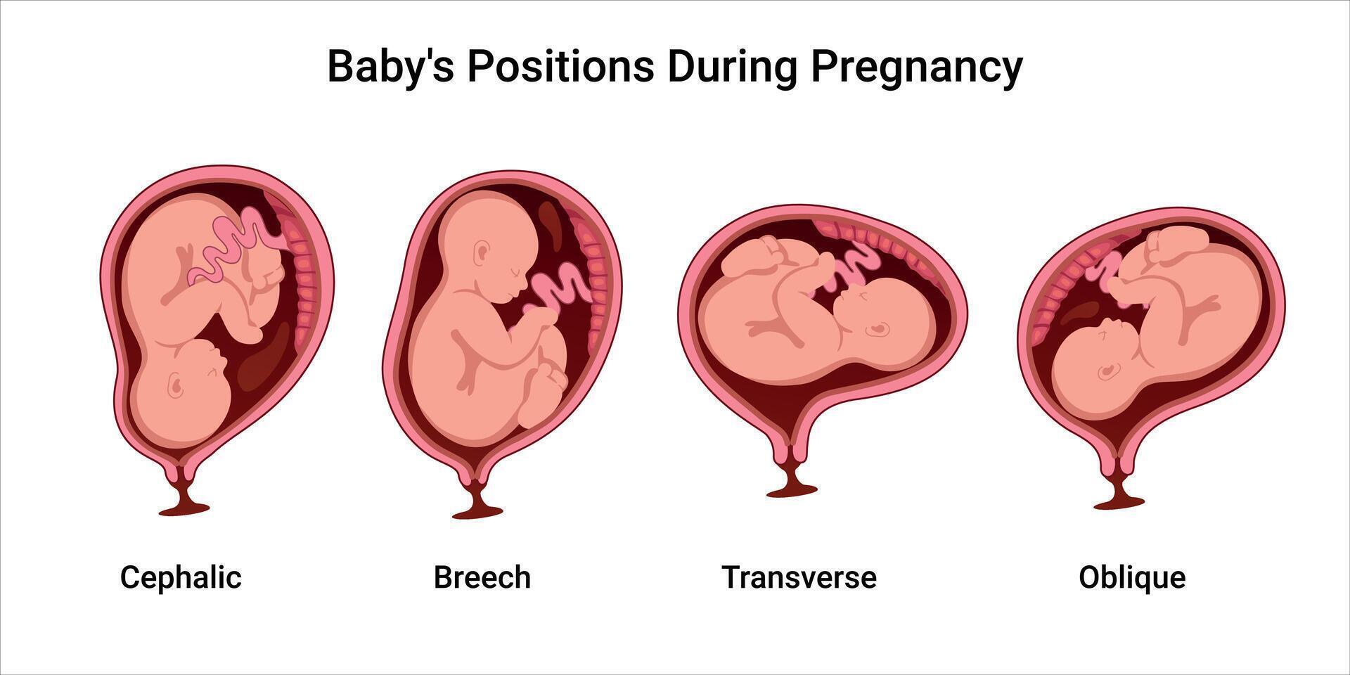 Baby positions during pregnancy illustration vector