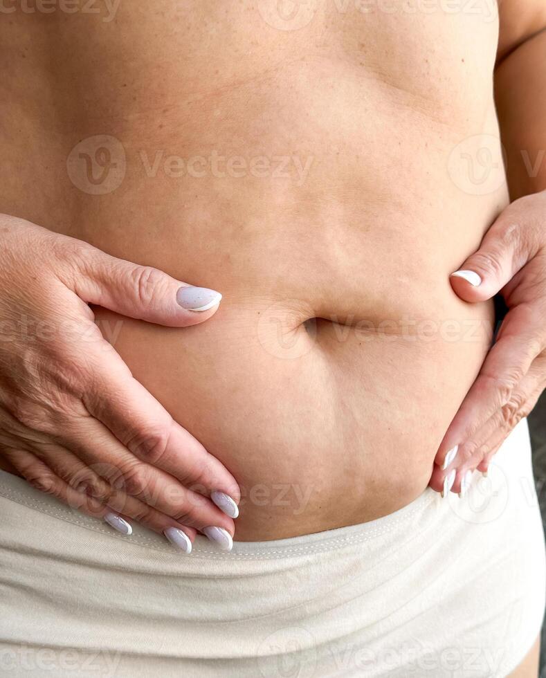 Close up of belly with hands gently touching in beige underwear on white background. Maternity and motherhood concept. Design for healthcare, postpartum care, wellness photo