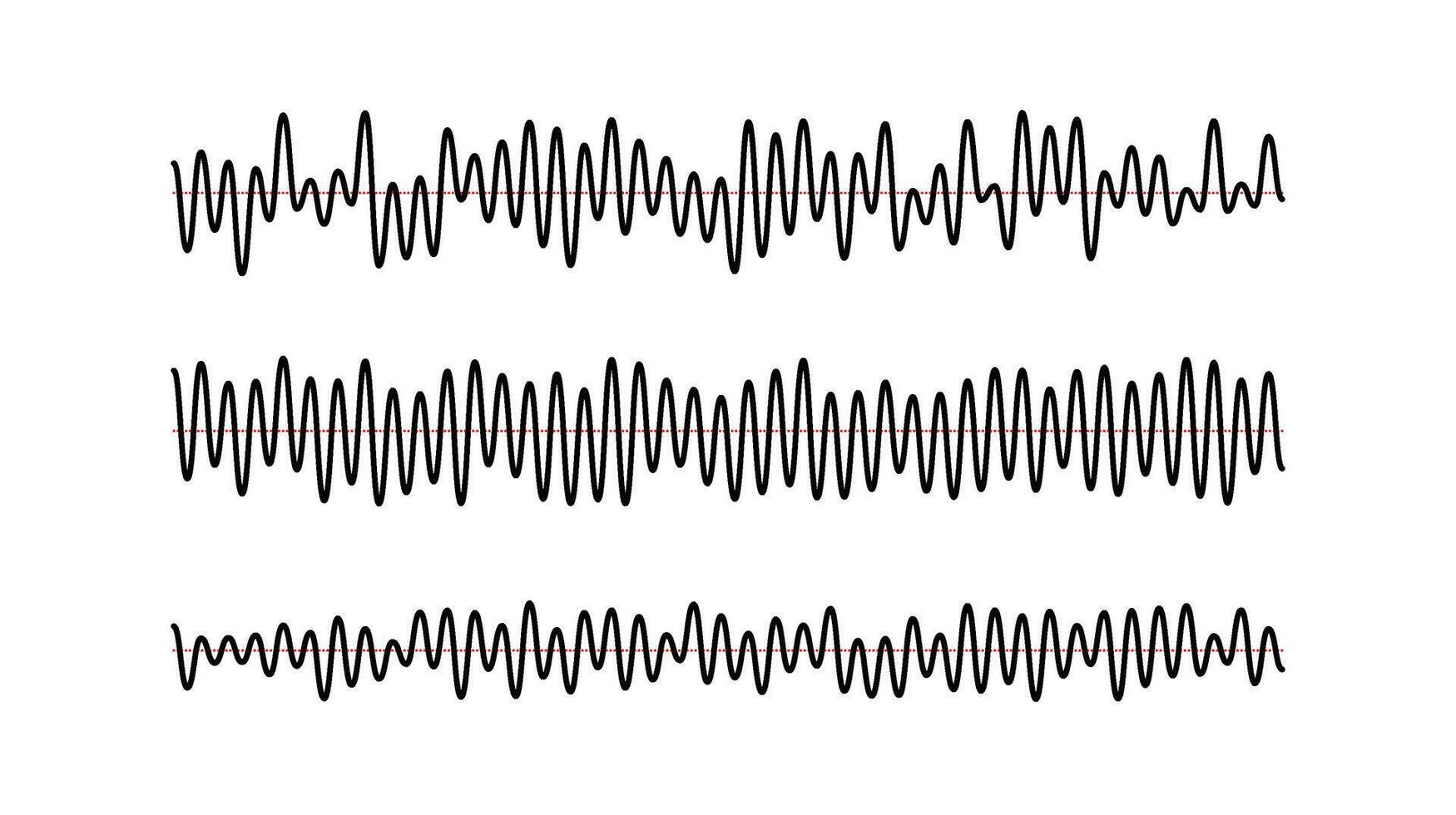 Sound wave signals set. Black audio track beats diagram collection. Voice or music sample concept. Pulse lines. Electronic radio graphics with different frequency and amplitude. vector